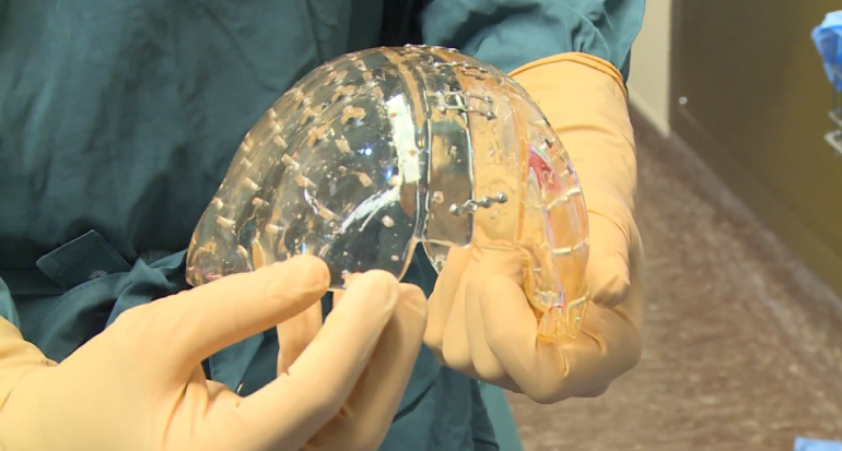 The Future of 3D Printing in Healthcare The Future of 3D Printing in Healthcare